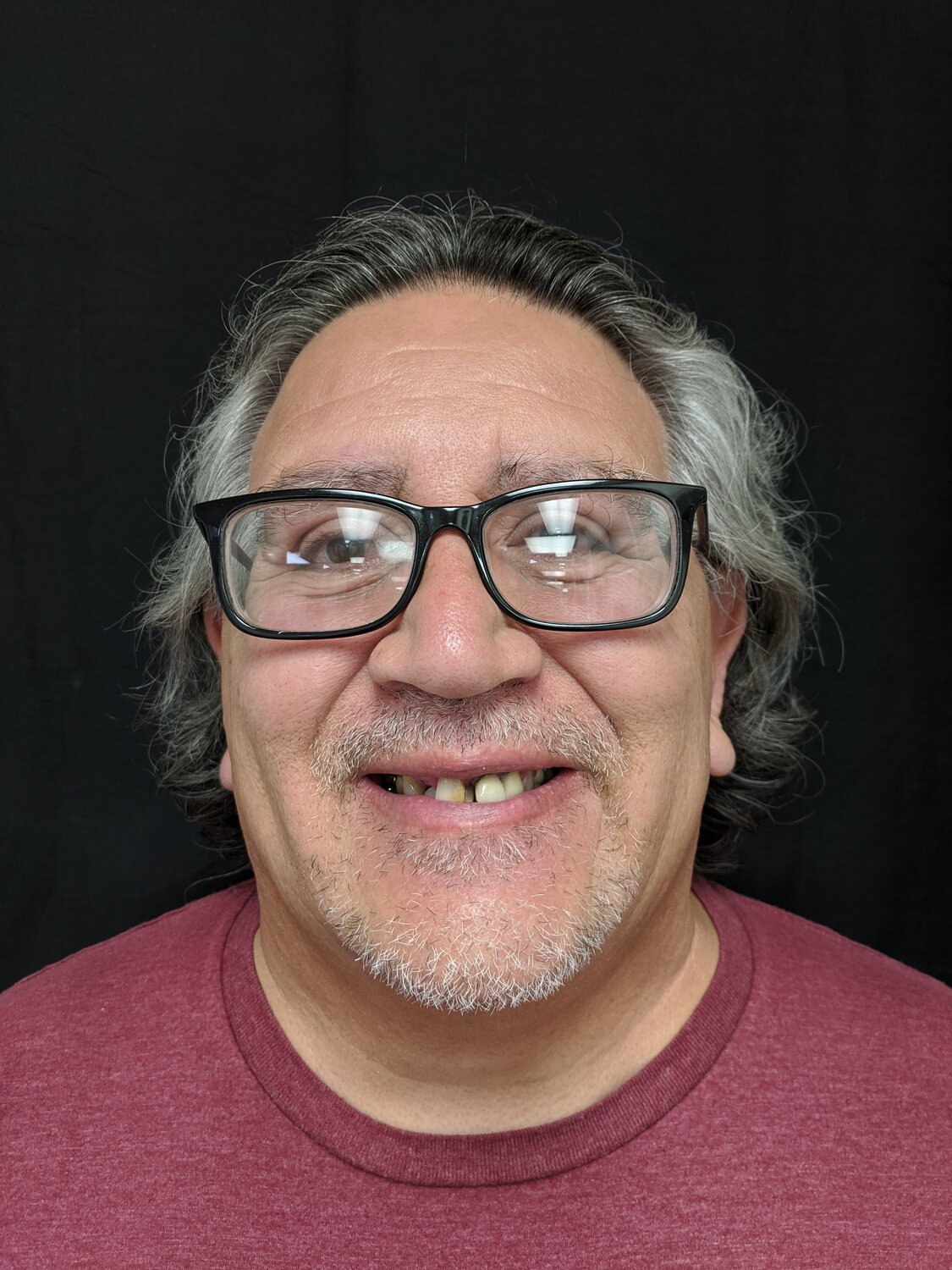Grant before comprehensive dental restoration with Dr. Rauch